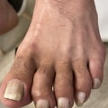 Expert Tips for Taking Care of Elderly Toenails