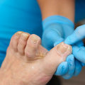 The True Cost of Toenail Cutting: What You Need to Know