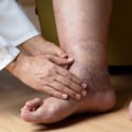 Expert Tips for Maintaining Healthy Feet as You Age