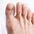 The Importance of Proper Toenail Care for the Elderly