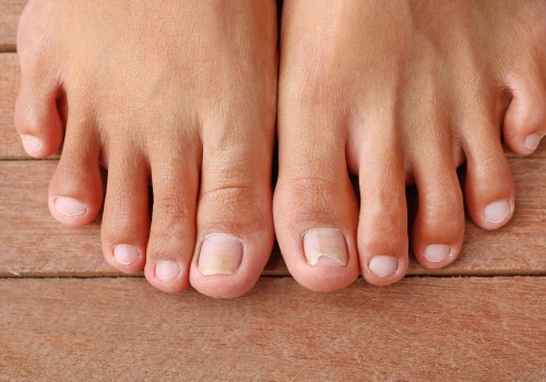 The Importance of Proper Toenail Care: Insights from a Podiatrist