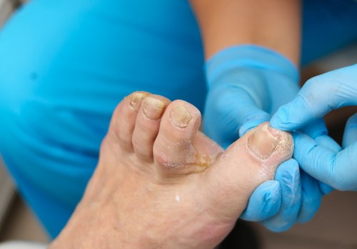 The True Cost of Toenail Cutting: What You Need to Know