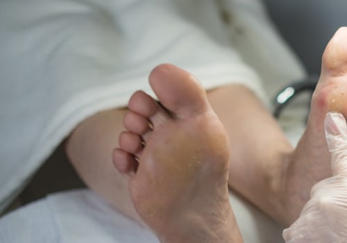 Understanding Medicare's Policy for Routine Foot Care