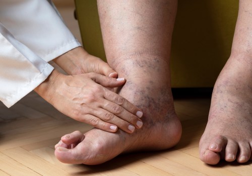 Expert Tips for Maintaining Healthy Feet as You Age