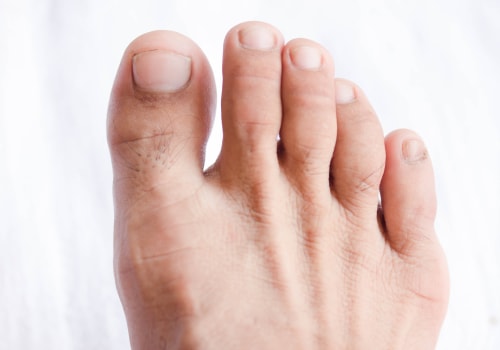 The Importance of Proper Toenail Care for the Elderly